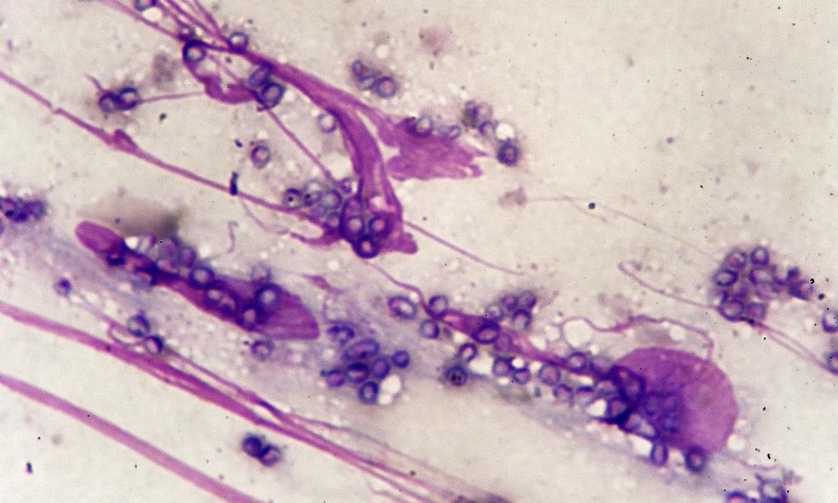 Cogumelos letais: conheça os 5 fungos mais perigosos da natureza