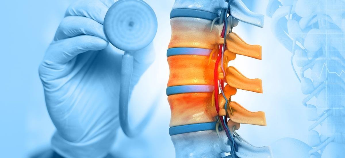 Polilaminina: veja perguntas e respostas sobre a molécula testada para tratar lesões medulares