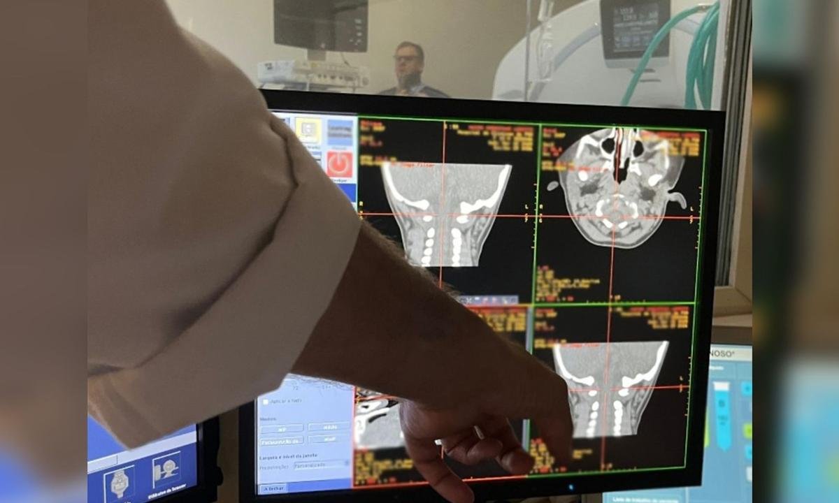 Fiocruz inicia teste em humanos de terapia gênica inédita contra AME