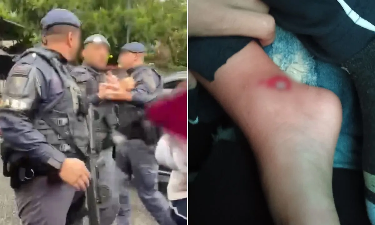 Viatura atropela menino em Santos e PM ameaça família; vídeo | G1