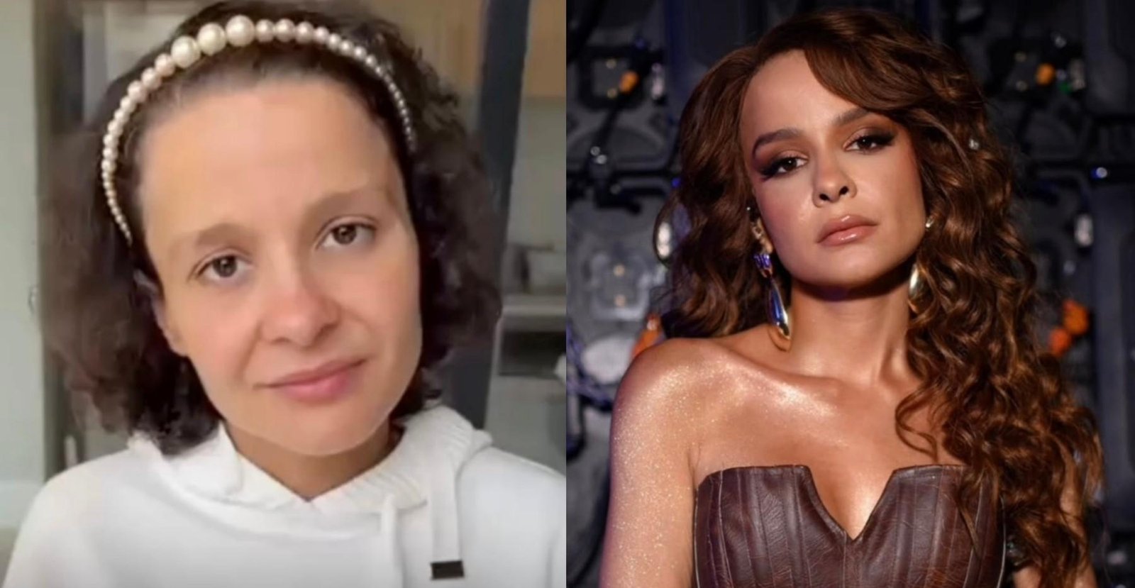 Alopecia feminina: Maiara abre debate sobre cabelo natural e especialistas explicam como lidar com a queda dos fios