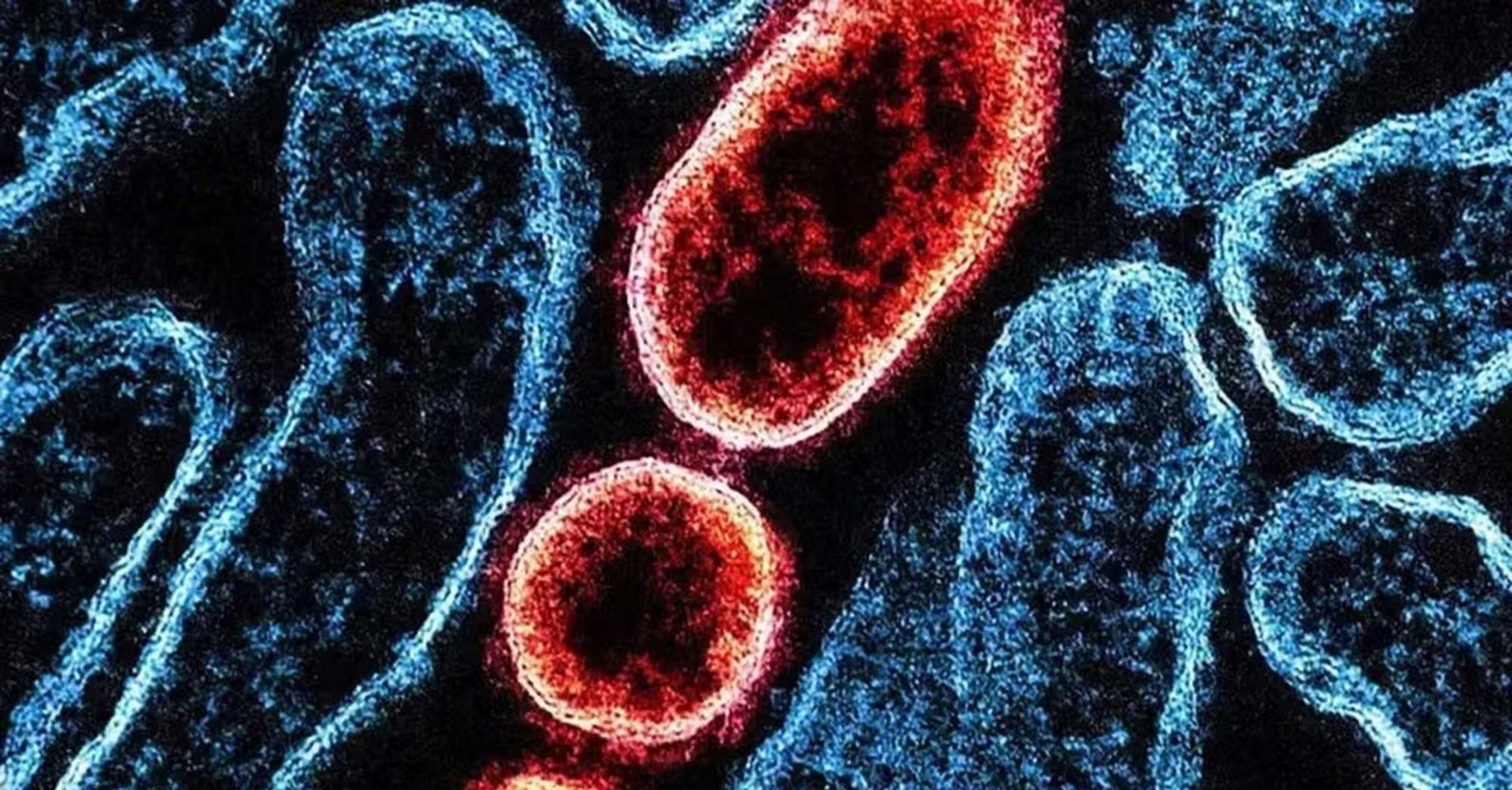 É falso que OMS alertou para risco global do vírus Nipah após Carnaval | G1