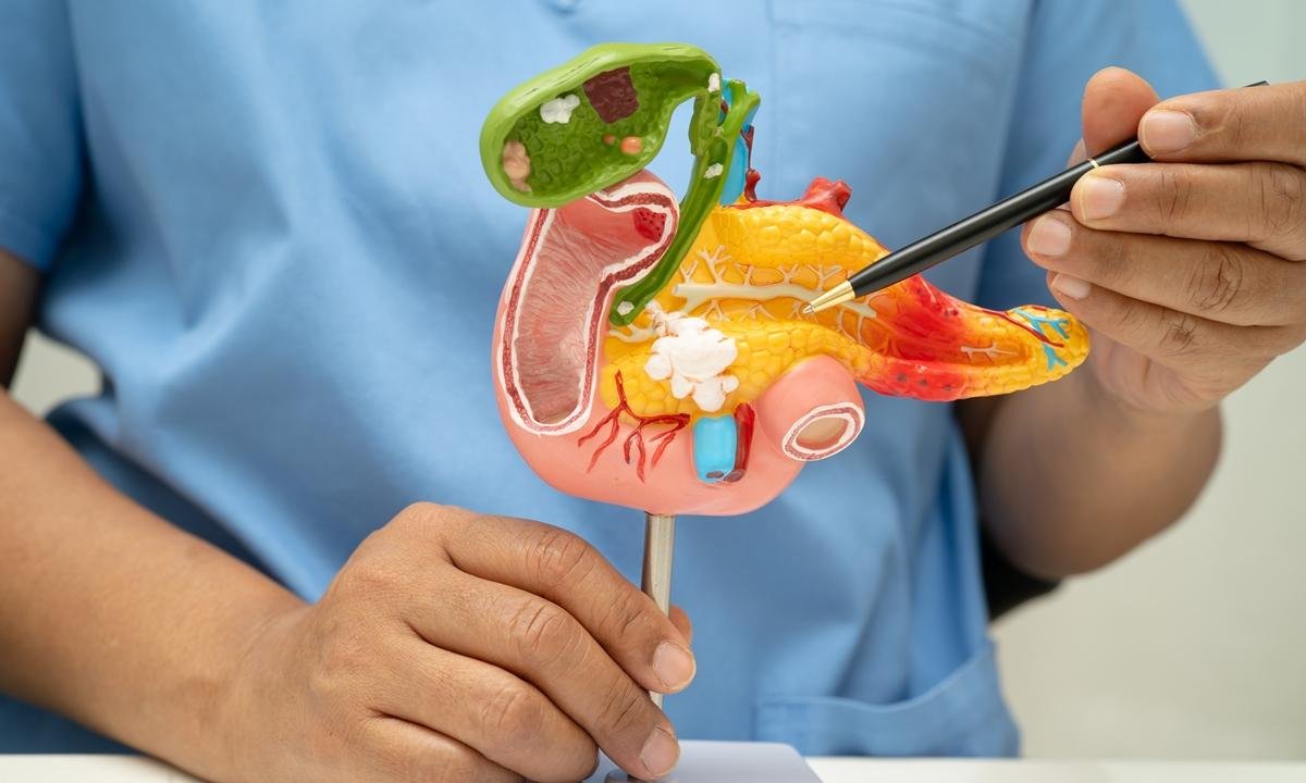O que é bom para limpar o pâncreas? 7 alimentos que fortalecem o órgão