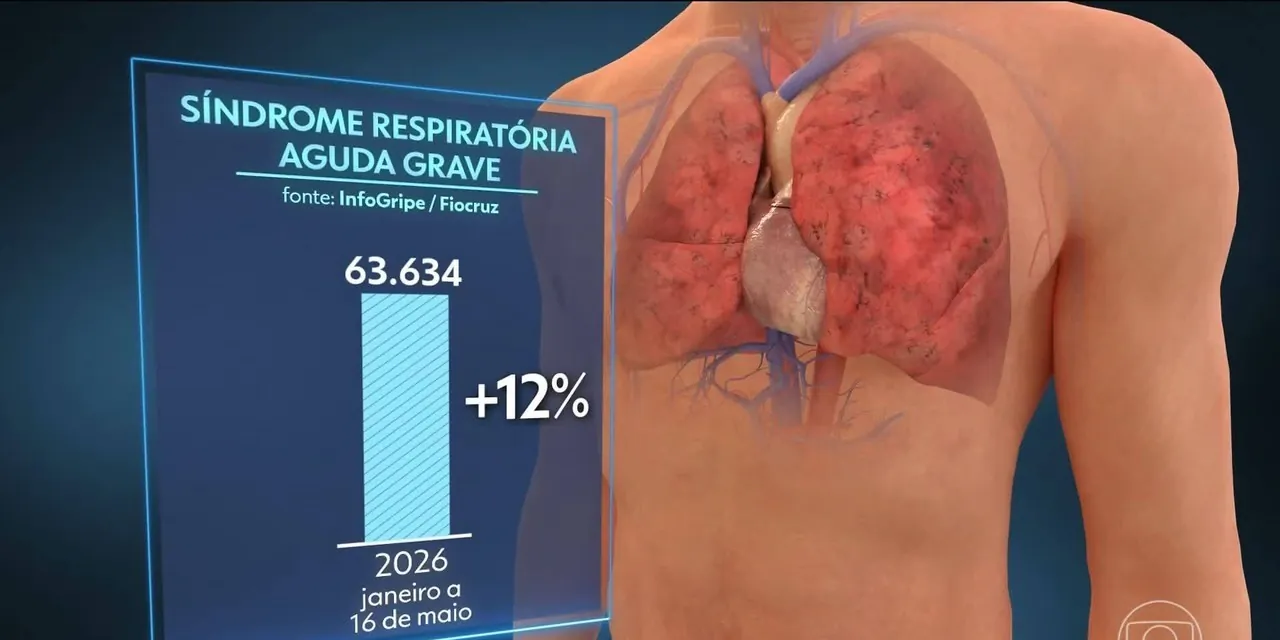Casos graves de gripe pressionam hospitais e acendem alerta em quase todo o Brasil