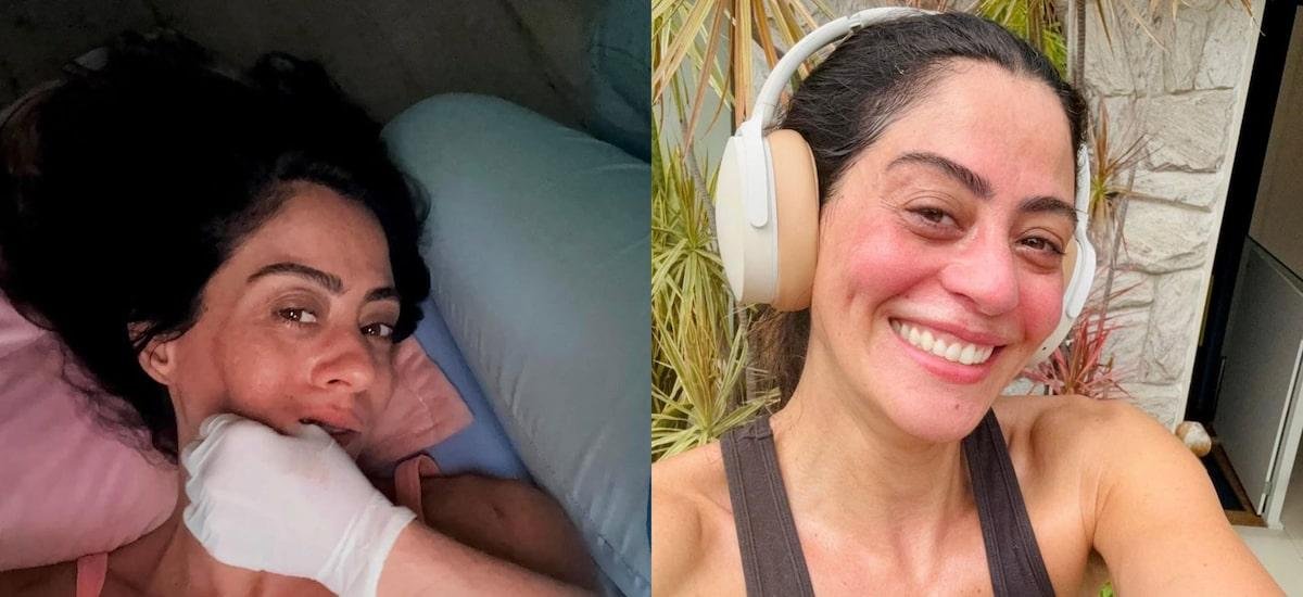 Carol Castro revela ter fibromialgia; conheça a doença