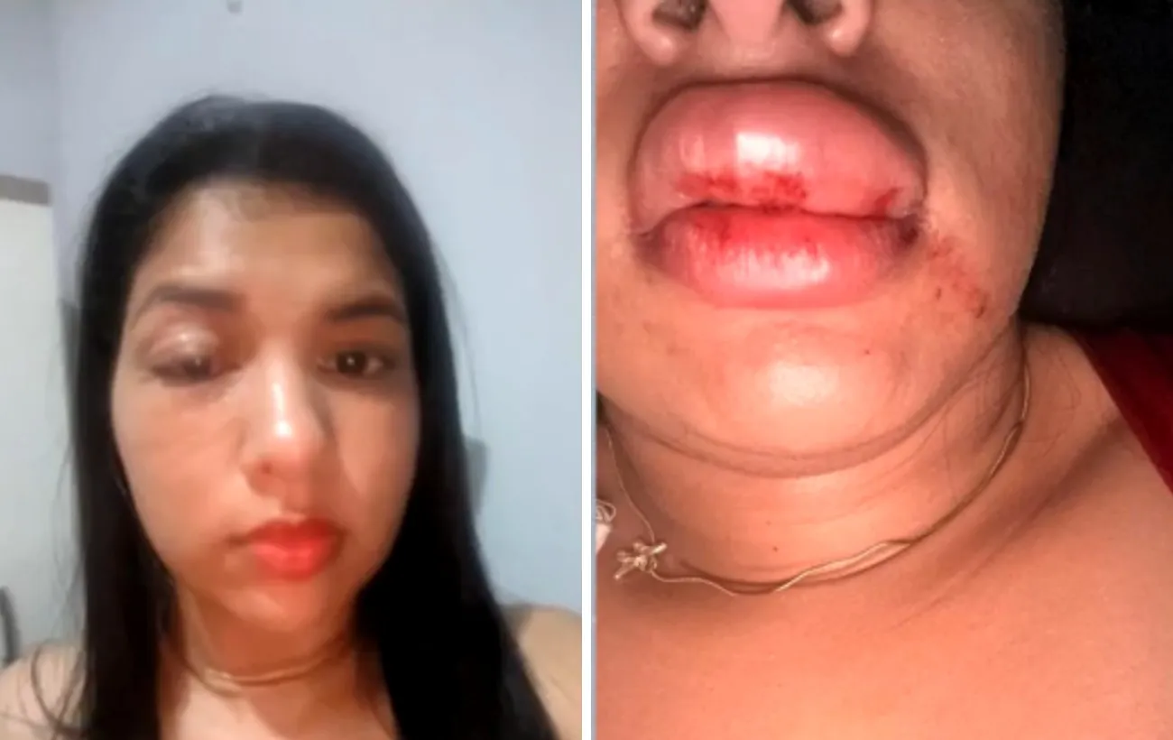 'Tendo que me esconder', diz jovem que denunciou vereador por agressão | G1