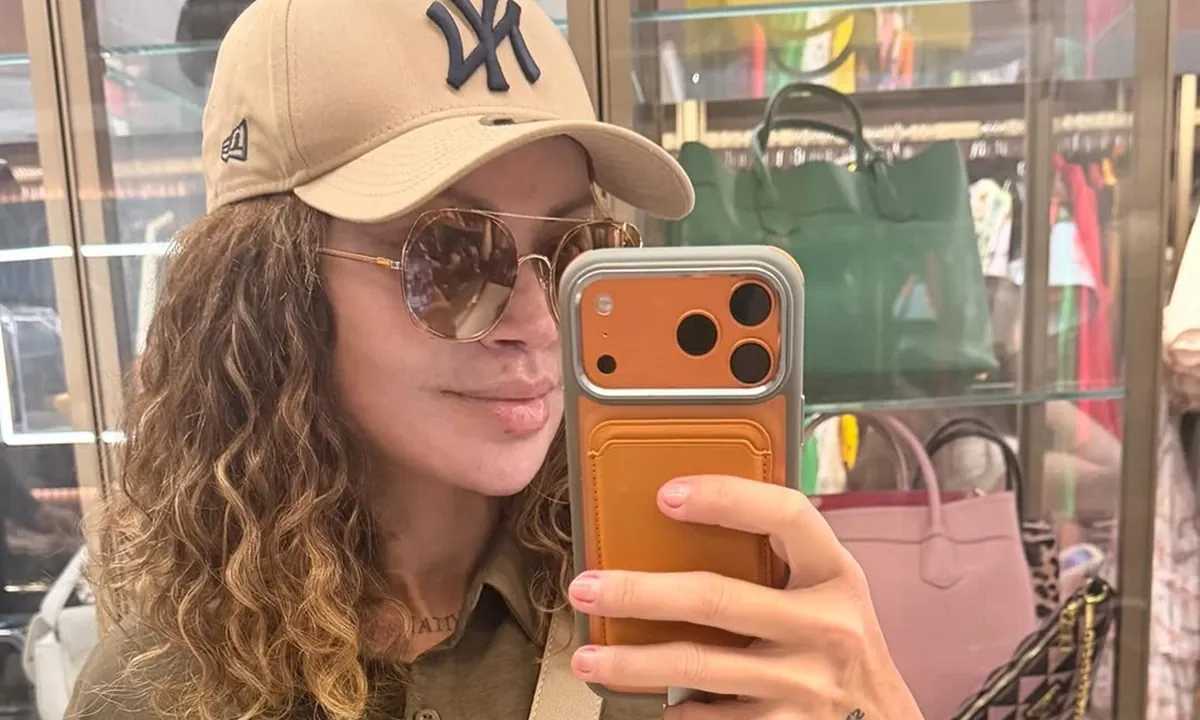 Mudança de Solange Almeida levanta debate sobre procedimentos faciais