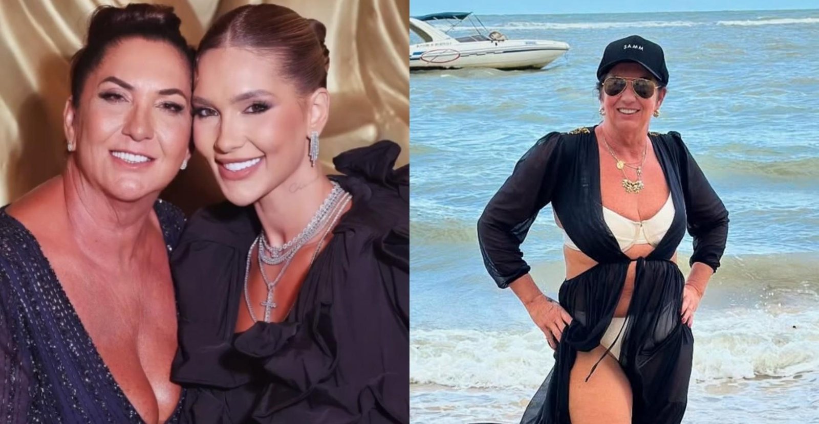 Transformação de Margareth Serrão, mãe de Virgínia Fonseca, reacende debate sobre combo de cirurgias plásticas