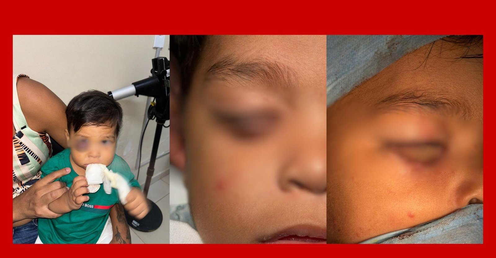 Criança de 1 ano passa por cirurgia complexa em hospital do DF | G1