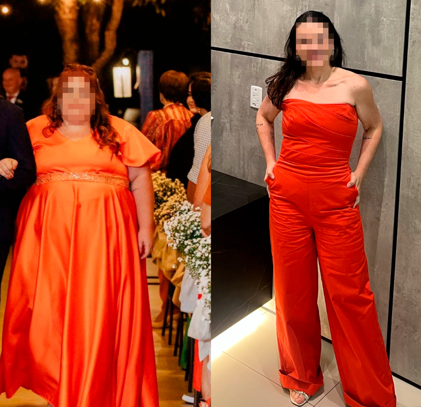 Obesidade é doença crônica e lipedema pode explicar dores e inchaço nas pernas | G1