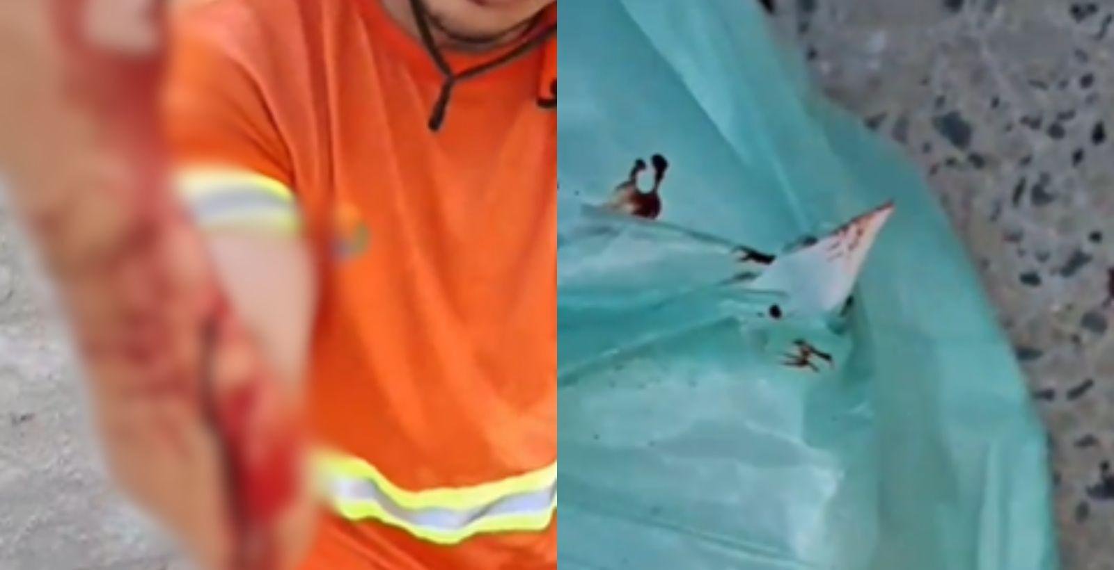 Gari sofre corte no braço ao recolher sacola com prato quebrado | G1