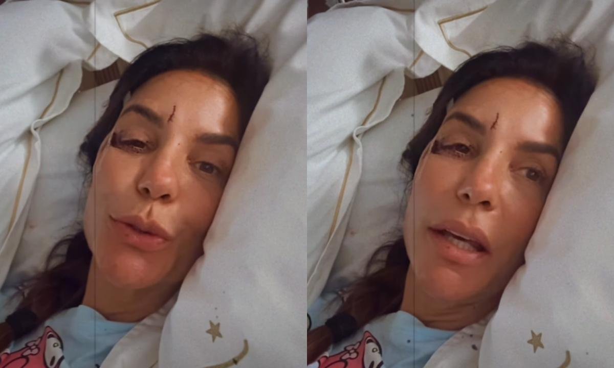"Eu desmaiei", diz Ivete Sangalo após sofrer acidente e ser internada