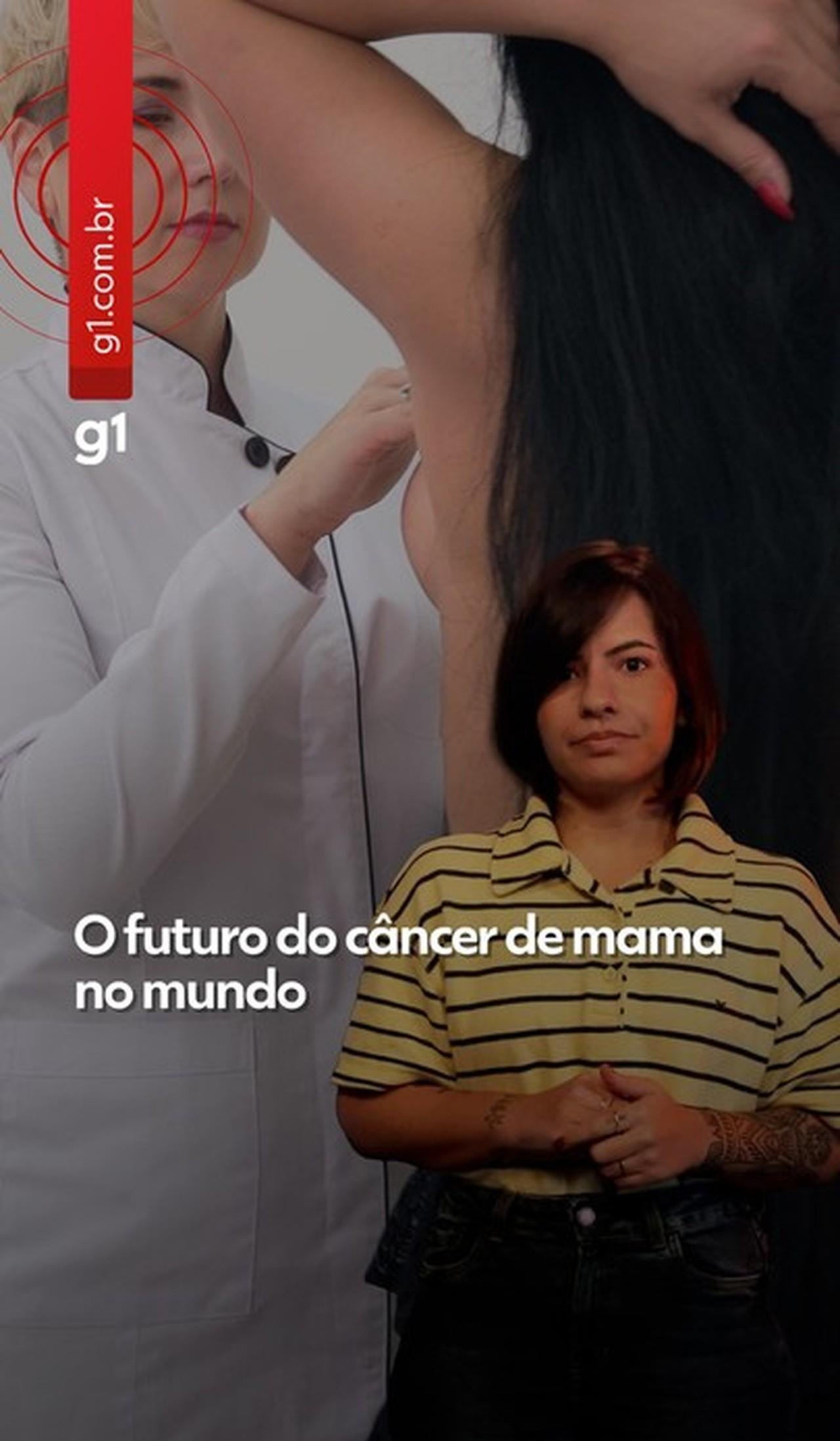 Casos de câncer de mama podem chegar a 3,5 milhões por ano até 2050; mortalidade cai em países ricos e dispara em nações pobres | G1