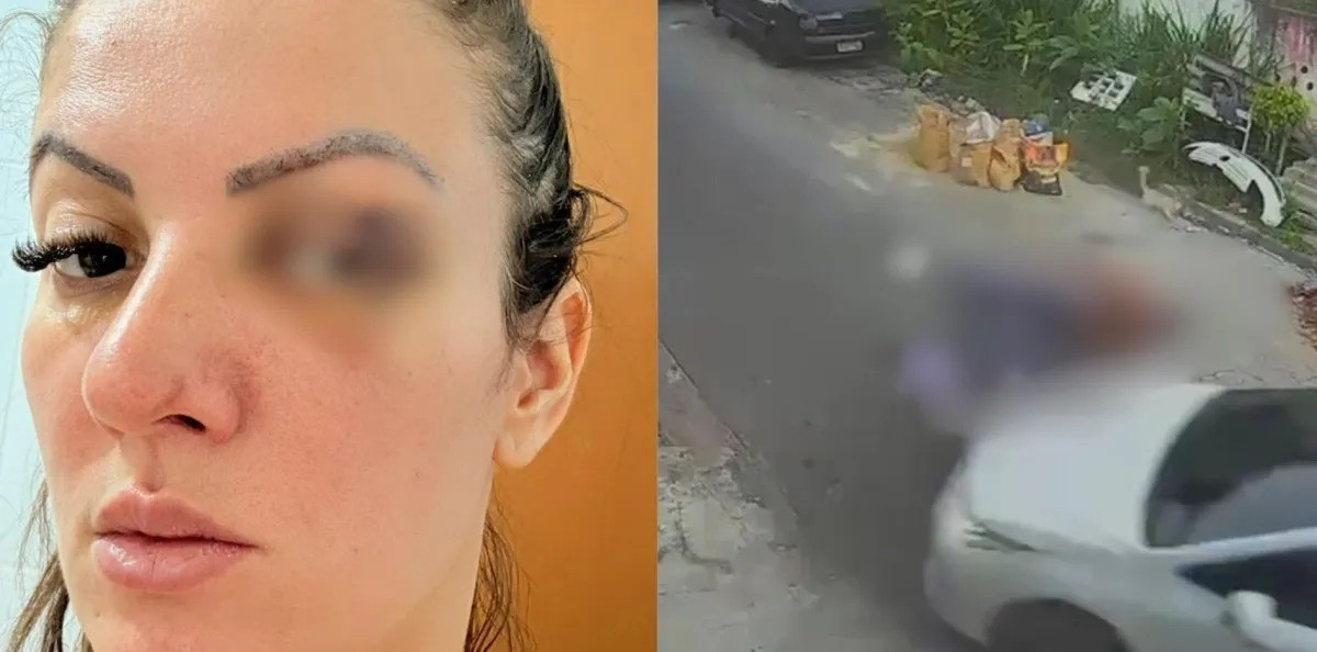 Vereadora que atropelou namorado em SP após agressão se manifesta sobre o caso; vídeo