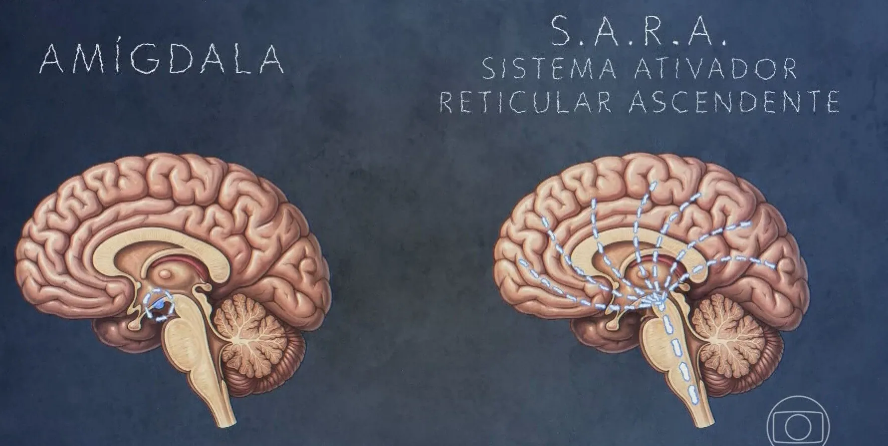 Saiba que mudanças ocorrem no cérebro de agressores de mulheres; VÍDEO | G1