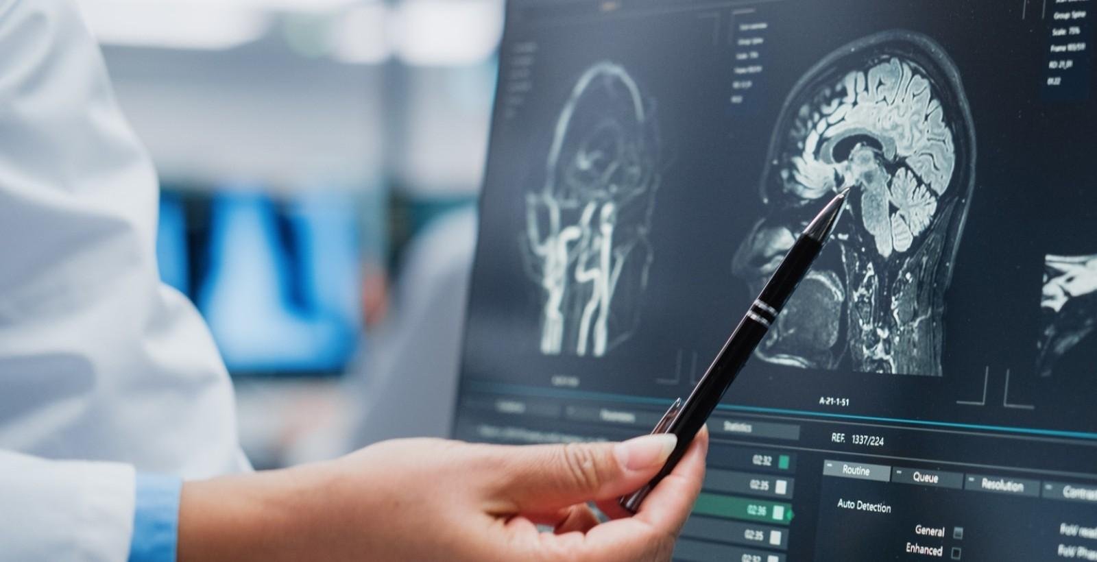 Unifor inaugura centro de tratamento e pesquisa em doenças raras | G1