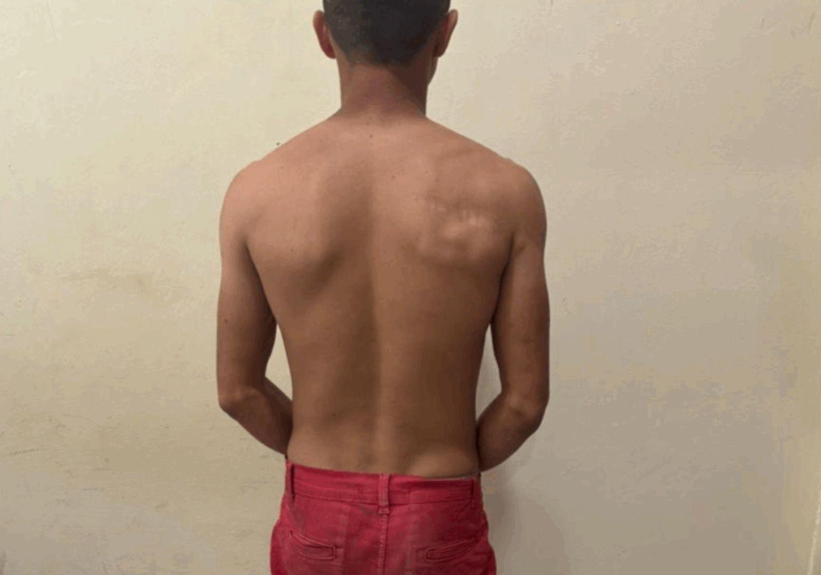 Homem que tentou matar indígena a facadas por ciúmes é preso no Acre | G1