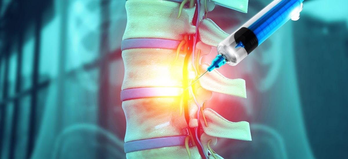 Polilaminina: Anvisa aprova início dos testes com pacientes com lesão medular