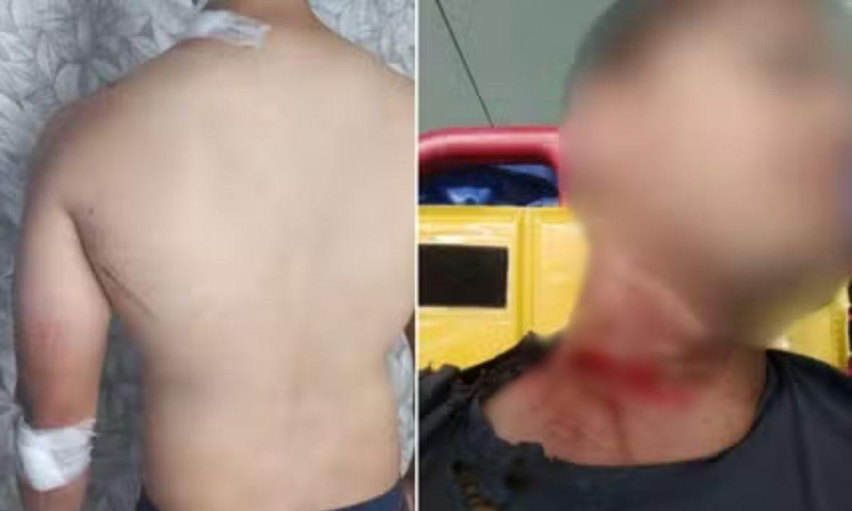 Prefeitura de Santos indenizará motociclista após queda por fiação | G1