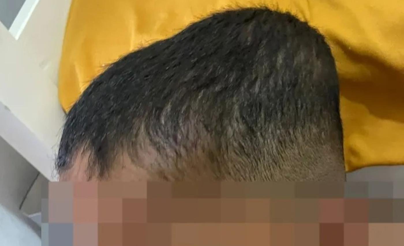 Babá é denunciada por agressão contra criança autista em Alagoas