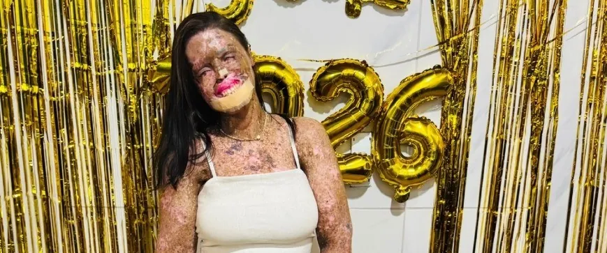 Káh Felipe: entenda o que é xeroderma pigmentoso, doença que afetava a influenciadora