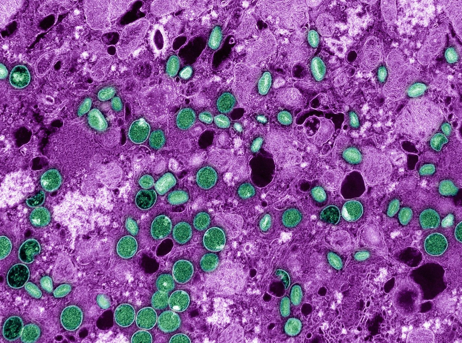 Mpox: tudo que se sabe sobre a doença e como se prevenir