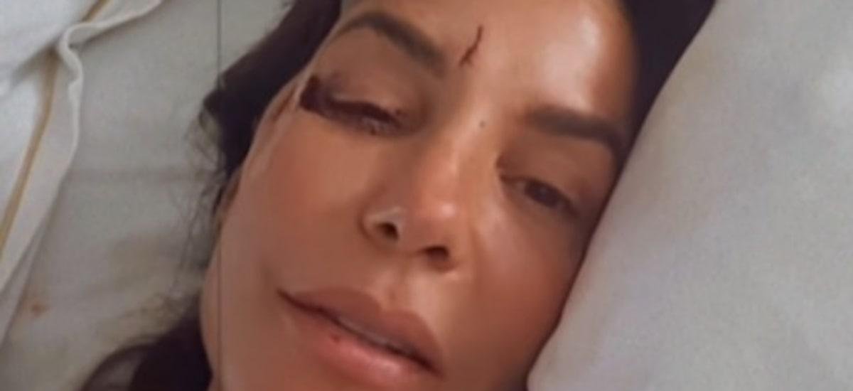 Ivete Sangalo é internada em Salvador após desmaio em casa