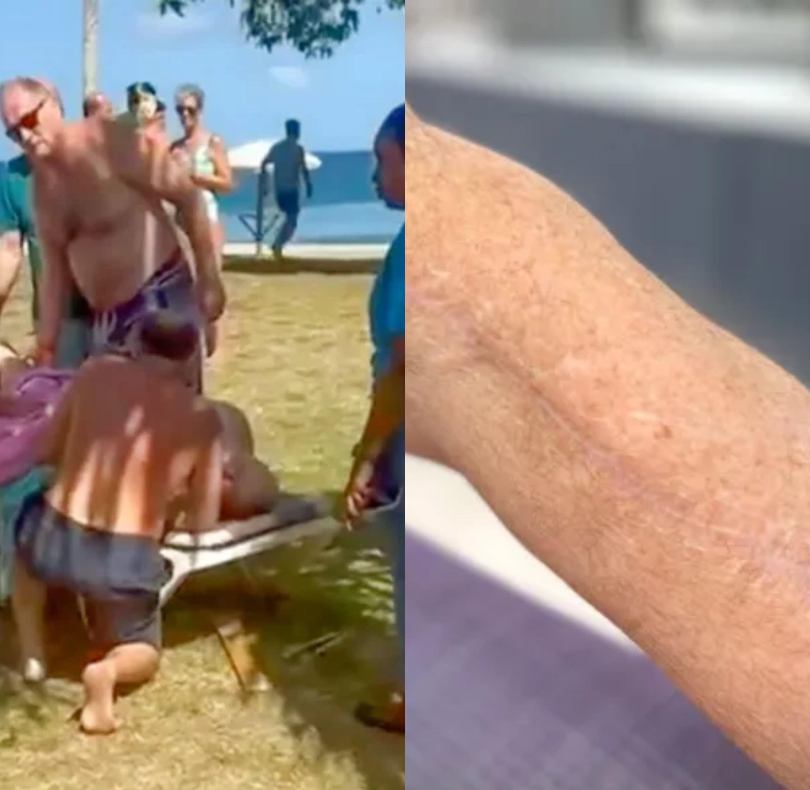 Turista britânico sobrevive a ataque raro de tubarão em Tobago e diz não ter medo do mar: 'Nunca bati em nada com tanta força'