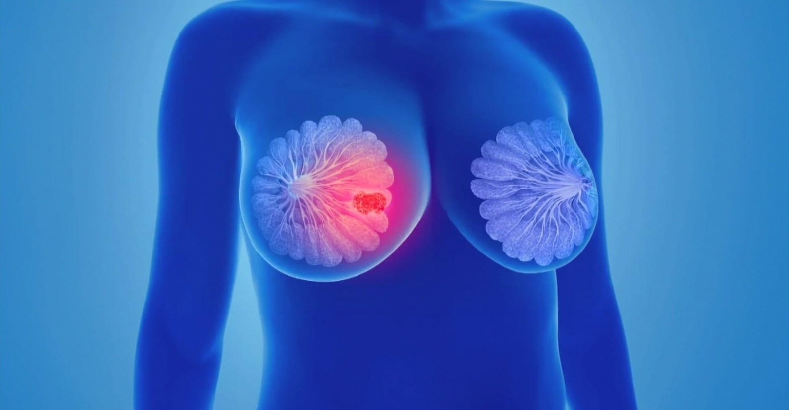 Quase 40% dos casos de câncer no mundo poderiam ser evitados, aponta OMS