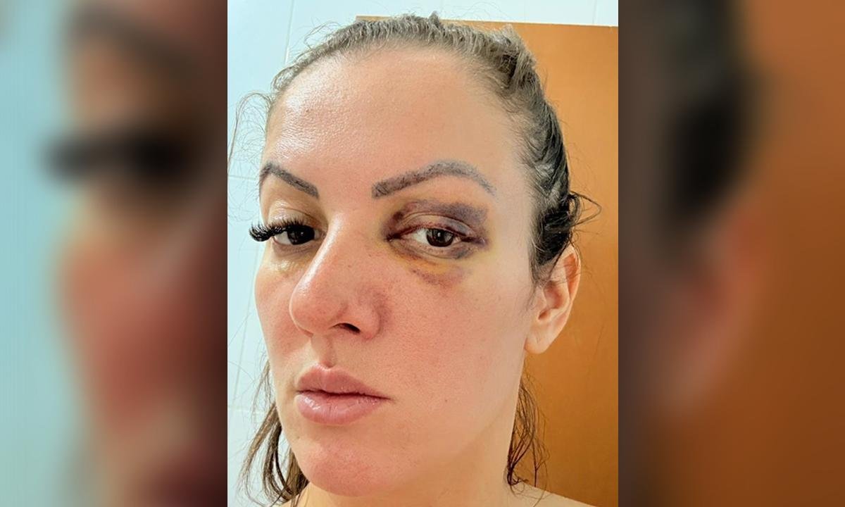 Namorado atropelado teria ameaçado vereadora de morte após agressão