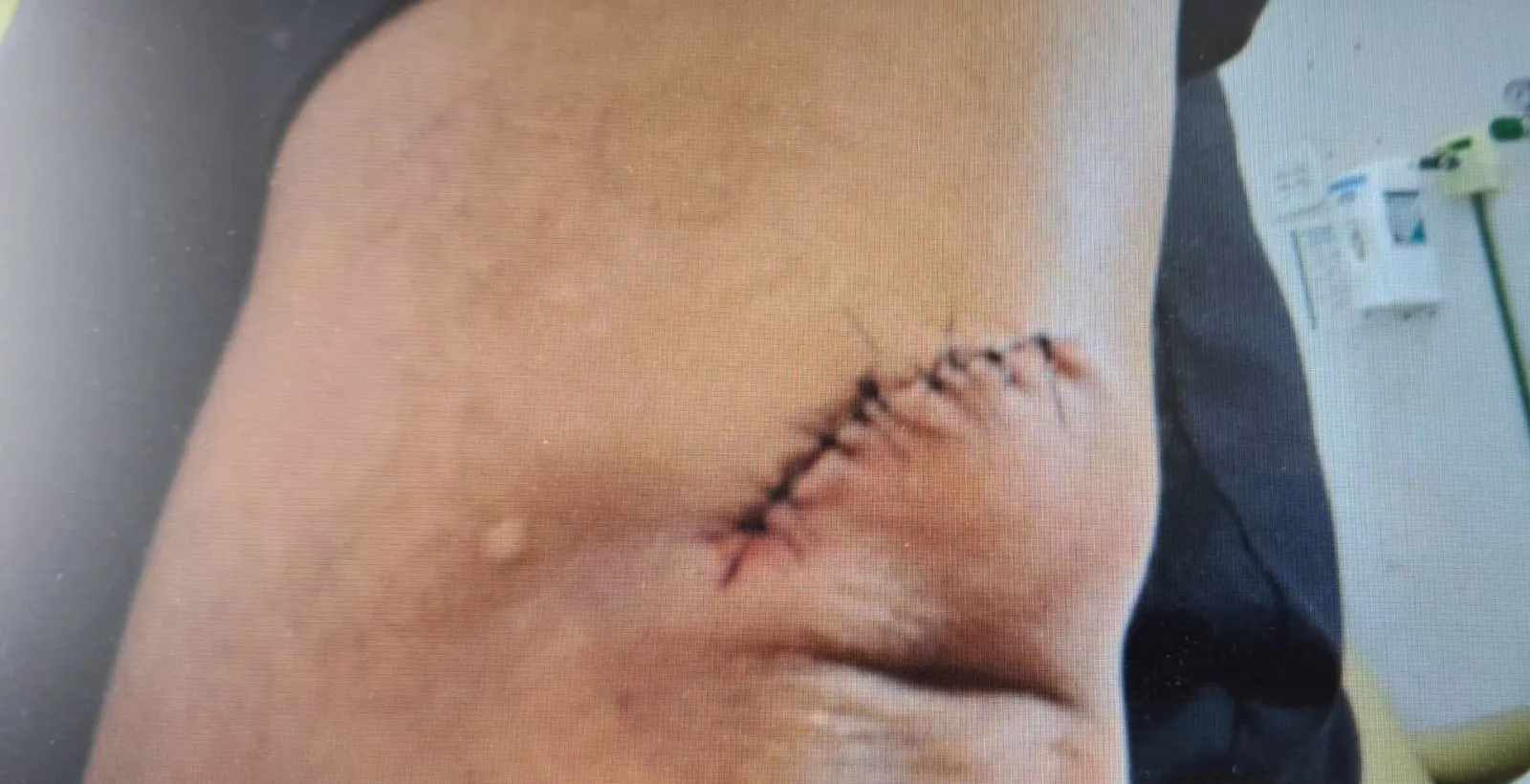 Motorista fere passageira após acusá-la de bater porta do carro em MG | G1