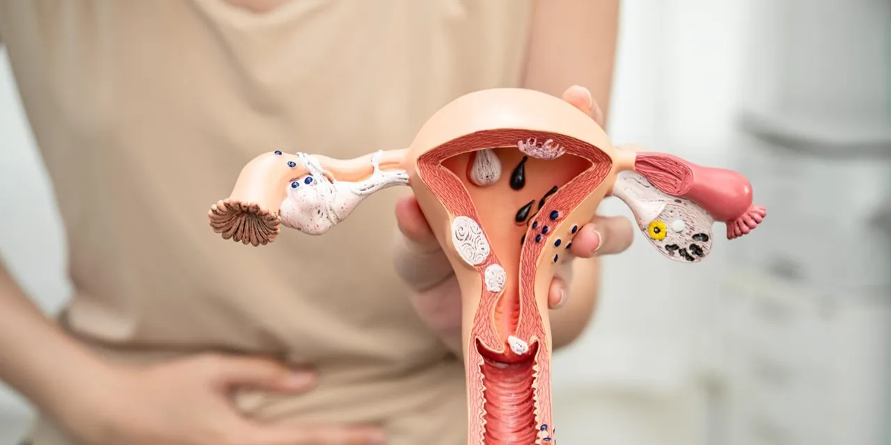 Março Amarelo; Endometriose afeta mais de 7 milhões de brasileiras | G1