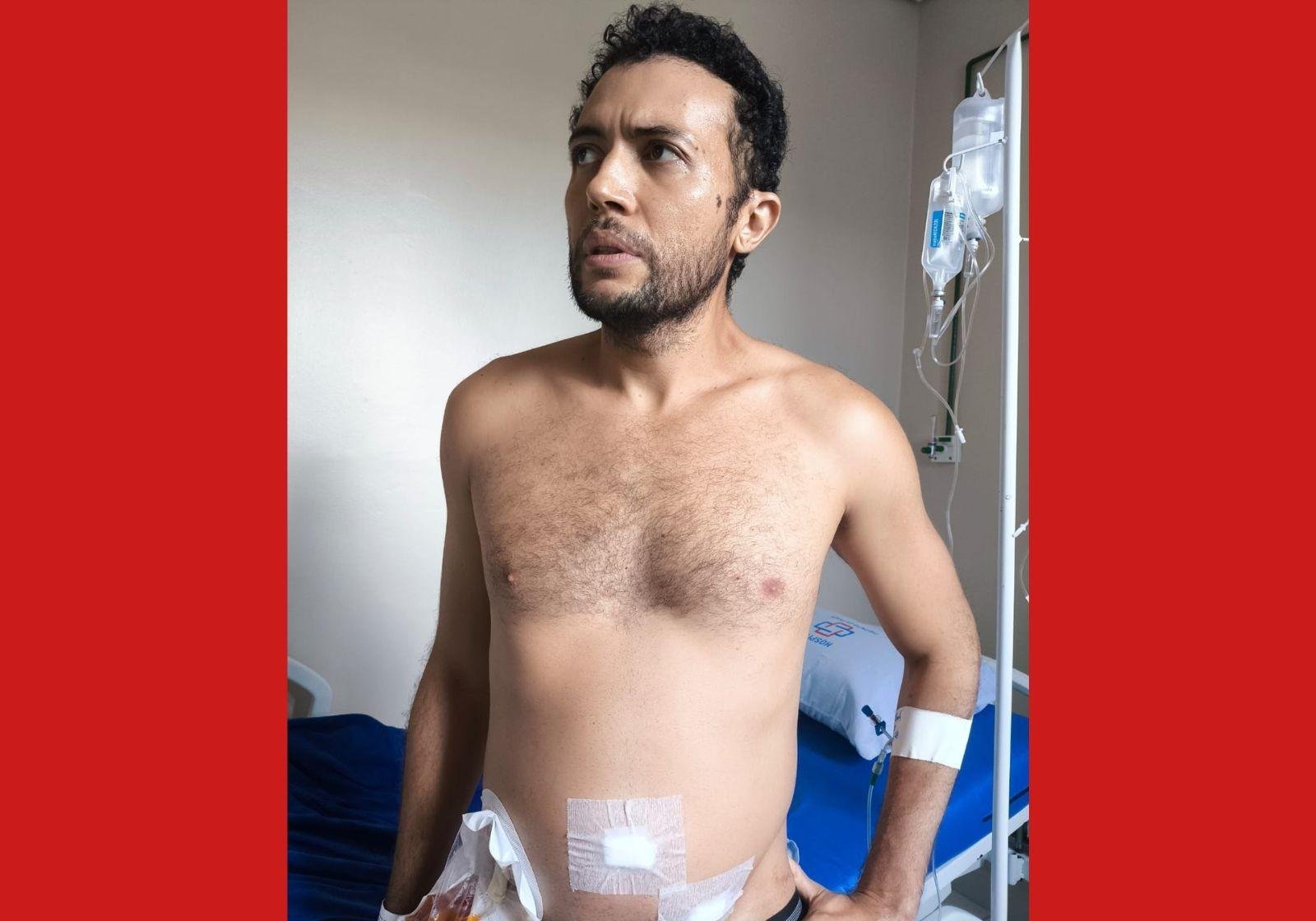 Professor passa por cirurgia de apendicite e esposa aponta negligência | G1